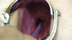 აზიელები ჩხირები, ბებო, საშო, მაშინ analizes მისი