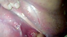 დედა ღამის ექთანი reflex