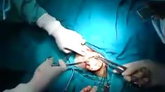 მკურნალობა, დიდ ძუძუები წლის