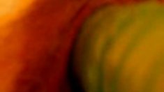 ეროტიული